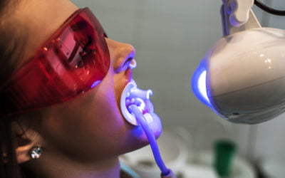 Jakimi metodami wybiela się zęby?