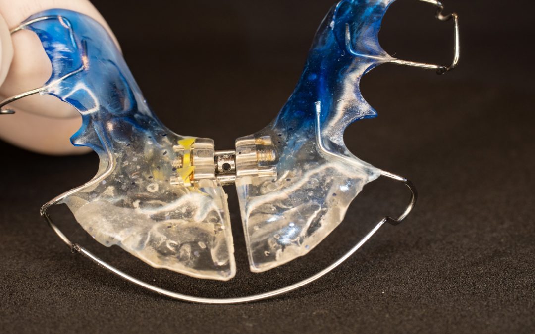 ruchomy aparat ortodontyczny