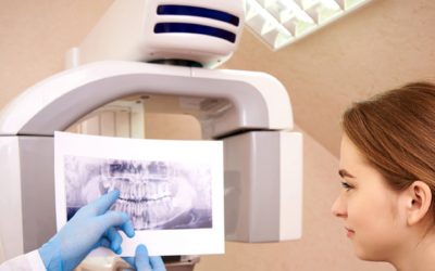 Jak wykonuje się tomografię komputerową zęba?