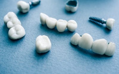 Czy implanty zębowe wystarczają na całe życie?