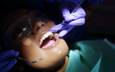Metody leczenia niedojrzałych zębów stałych
