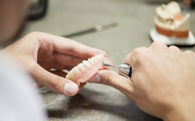 Jak przebiega proces dopasowania protezy zębowej?